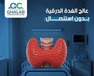 علاج تضخم الغدة الدرقية بالأشعة التداخلية | د. محمود عبد العزيز غلاب