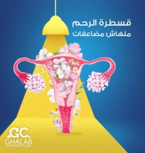 علاج الأورام الليفية مع الدكتور محمود غلاب خبير الأشعة التداخلية