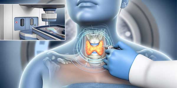 علاج تضخم الغدة الدرقية بالأشعة التداخلية
