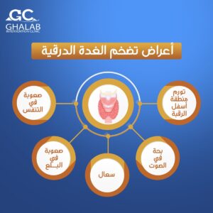 علاج الغدة الدرقية بالأشعة التداخلية