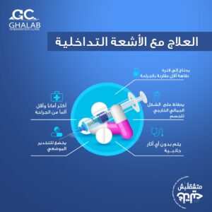 علاج تضخم الغده الدرقية بالأشعة التداخلية