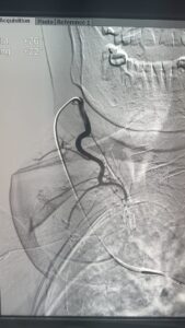 من أجل طبٍّ أكثر دقة و رحمة.. الدكتور محمود غلاب يقود ثورة علاجية في تضخم الغدة الدرقية بالأشعة التداخلية