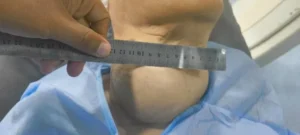 فخر مصرى جديد فى مجال الأشعة التداخلية: د. محمود عبد العزيز غلاب ينقل تجربة يابانية فريدة إلى مصر