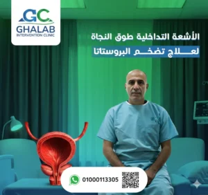 أفضل دكتور لعلاج البروستاتا فى مصر: د. محمود عبد العزيز غلاب
