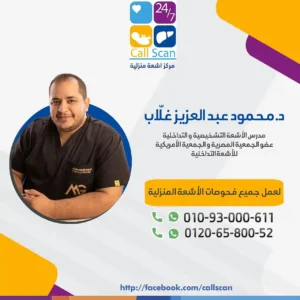 دكتور محمود عبد العزيز غلاب المدير التنفيذى لمركز كول سكان –call scan