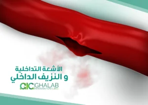 الأشعة التداخلية فى حالات النزيف و الطوارئ | د. محمود عبد العزيز غلاب