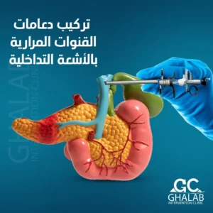 ألأشعة التداخلية لها دور فى تثبيت دعامات لإنقاذ الكبد و القنوات.