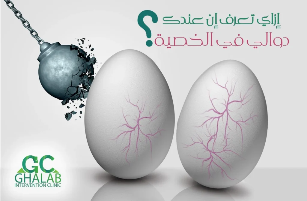 ما هى دوالى الخصية؟ الأسباب و طرق العلاج الحديثة بدون جراحة