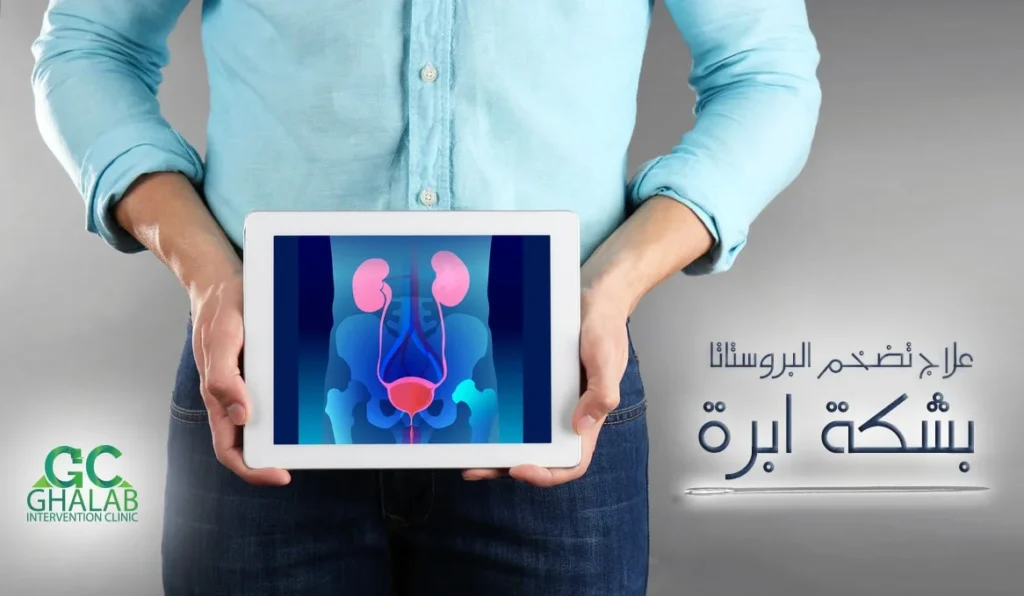 علاج تضخم البروستاتا
