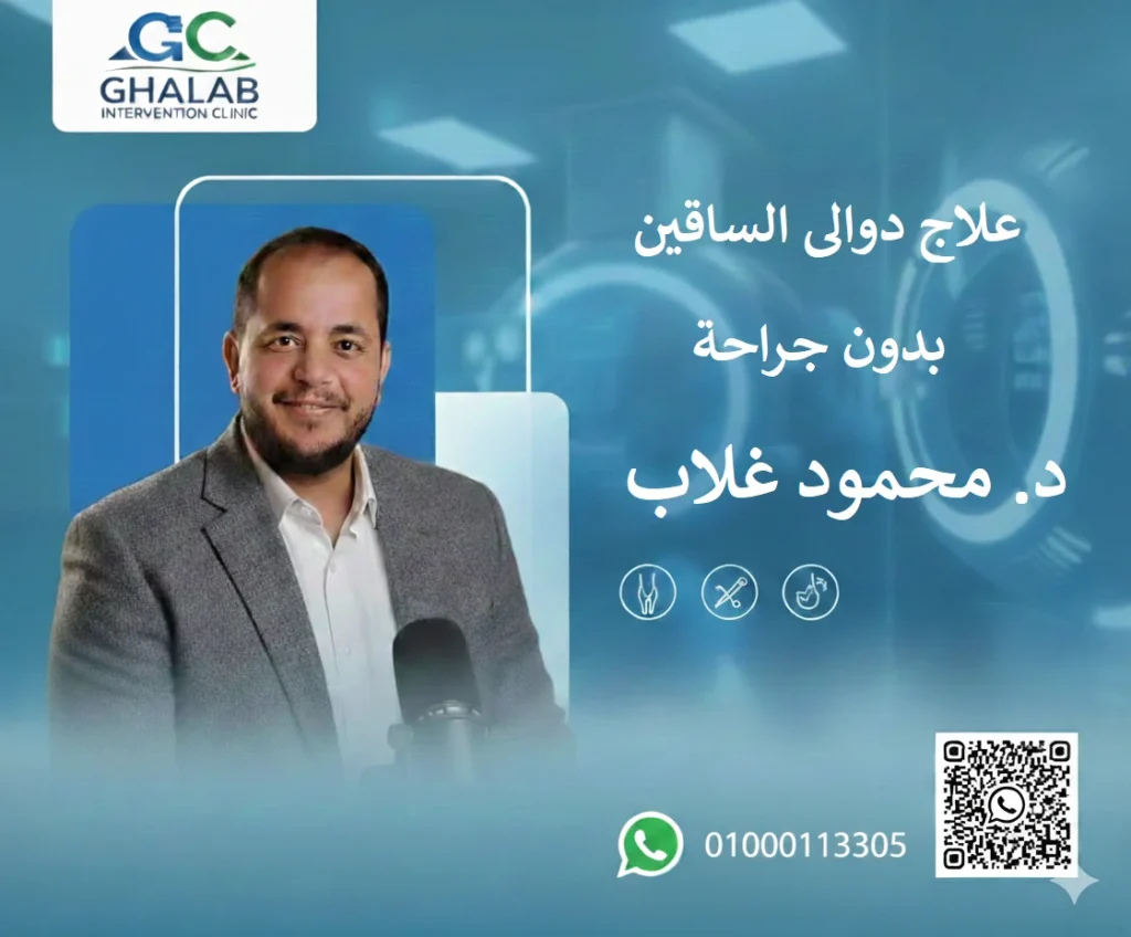 علاج دوالى الساقين بالأشعة التداخلية بدون جراحة | د. محمود غلاب