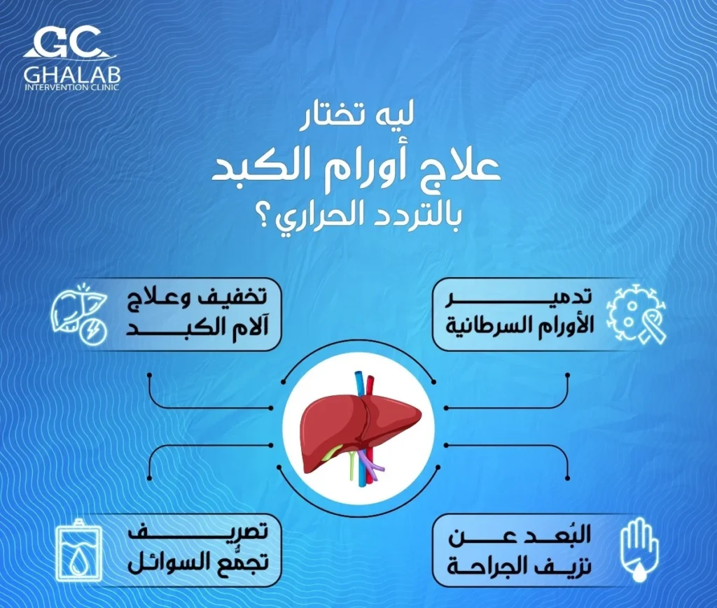علاج أورام الكبد بالتردد الحرارى مع د. محمود غلاب