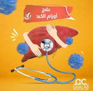 هل وجود بؤرة فى الكبد يعنى وجود أورام سرطانية؟ | د. محمود غلاب يوضح الفرق بين البؤر الحميدة و الخبيثة و طرق العلاج بالأشعة التداخلية