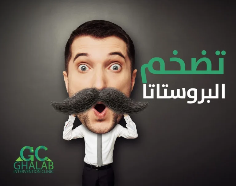 علاج تضخم البروستاتا | د. محمود غلاب