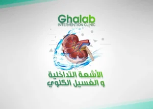 الأشعة التداخلية و الغسيل الكلوى | د. محمود غلاب