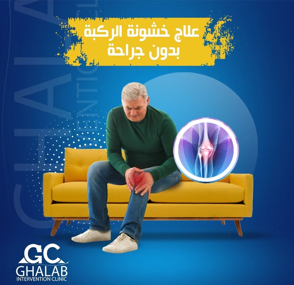 علاج خشونة الركبة بدون جراحة بالأشعة التداخلية: أحدث التقنيات الطبية للتخلص من ألم الركبة| د. محمود غلاب