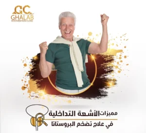 علاج تضخم البروستاتا بالأشعة التداخلية | د. محمود غلاب