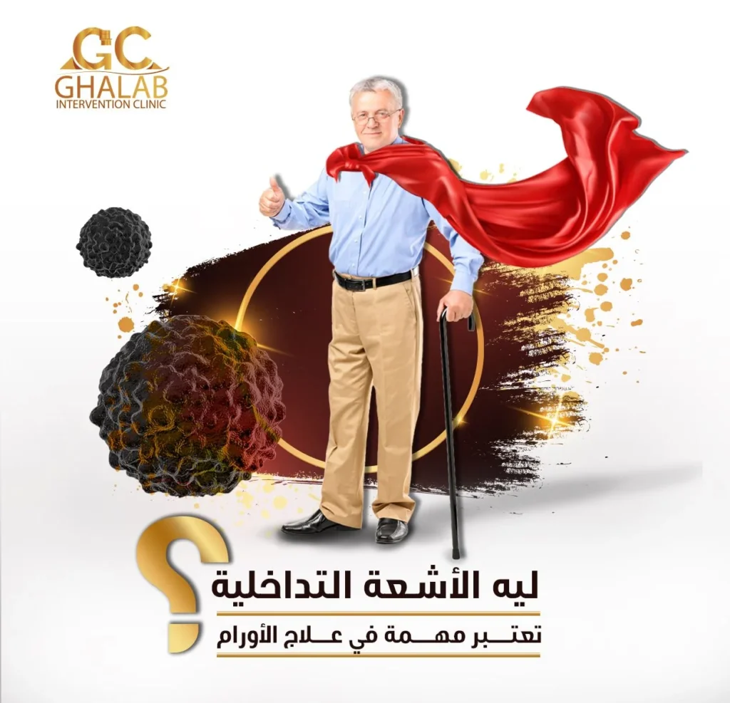 دور الأشعة التداخلية فى علاج الأورام| د. محمود غلاب