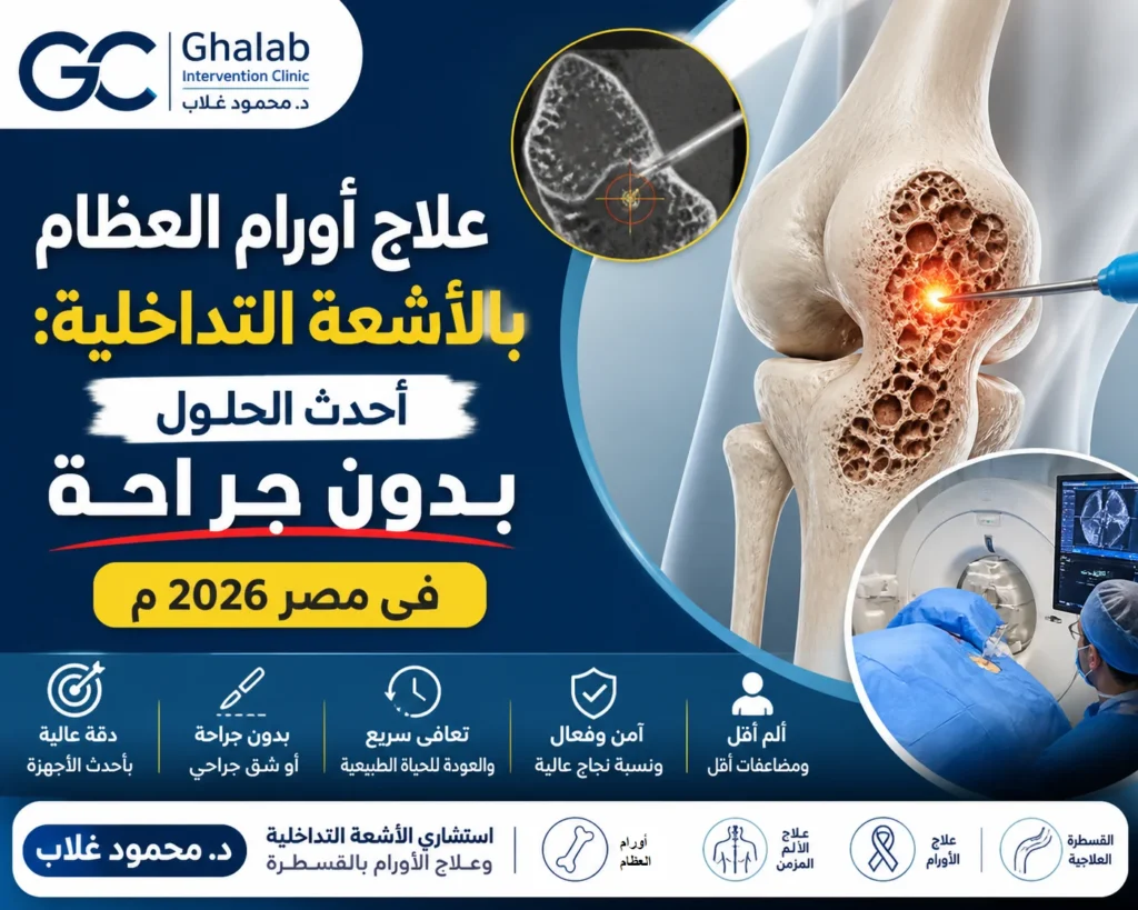 علاج أورام العظام بدون جراحة