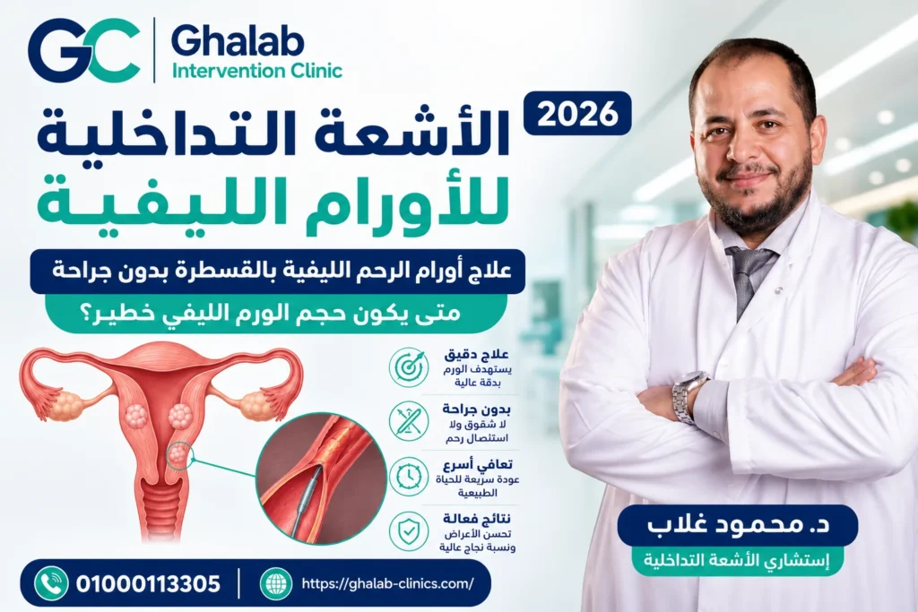 الأشعة التداخلية للأورام الليفية
