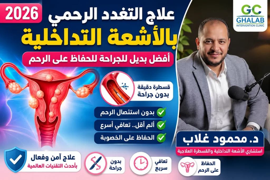 علاج التغدد الرحمى بالأشعة التداخلية