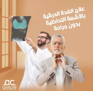 علاج الغدة الدرقية بدون جراحة بالأشعة التداخلية | د. محمود غلاب