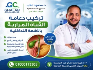 تركيب دعامة القناة المرارية بالأشعة التداخلية 2026 | د. محمود غلاب