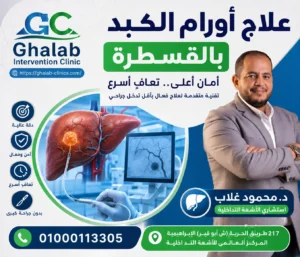 علاج أورام الكبد بالقسطرة 2026: أحدث طرق العلاج ومتى تكون القسطرة مناسبة؟، هل يمكن الشفاء من وجود بؤر على الكبد؟| د. محمود غلاب