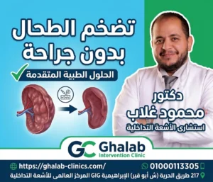 تضخم الطحال بدون جراحة 2026، هل تضخم الطحال بسبب تليف الكبد يمكن علاجه بالأشعة التداخلية؟، هل الانصمام الجزئي للطحال آمن؟| د. محمود غلاب