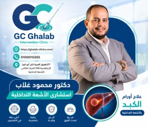 علاج أورام الكبد بالميكروويف بدون جراحة 2026: تقنية حديثة للقضاء على الورم بدون جراحة | المميزات والنتائج | د. محمود غلاب