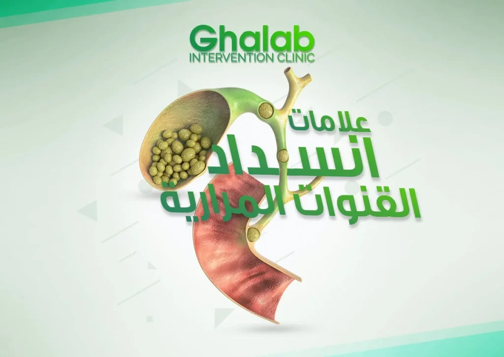 انسداد القنوات المرارية 2026: الأعراض والأسباب، متى يصبح خطيرًا؟، هل يمكن علاج حصوات القنوات المرارية بالأشعة التداخلية؟| د. محمود غلاب