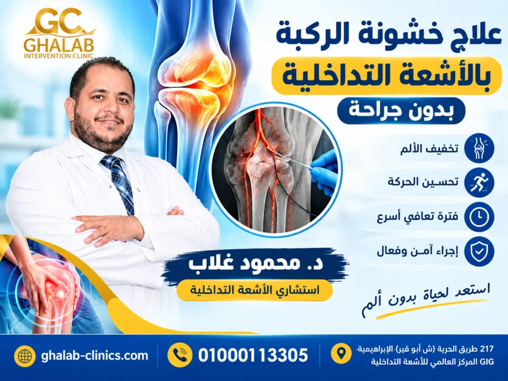 علاج خشونة الركبة بالأشعة التداخلية