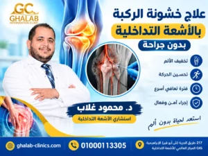 علاج خشونة الركبة بالأشعة التداخلية